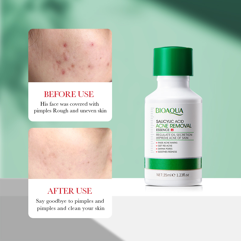 35ml BIOAOUA Salicylic Acid An - Tranexamic Acid Serum ulasan dan harga