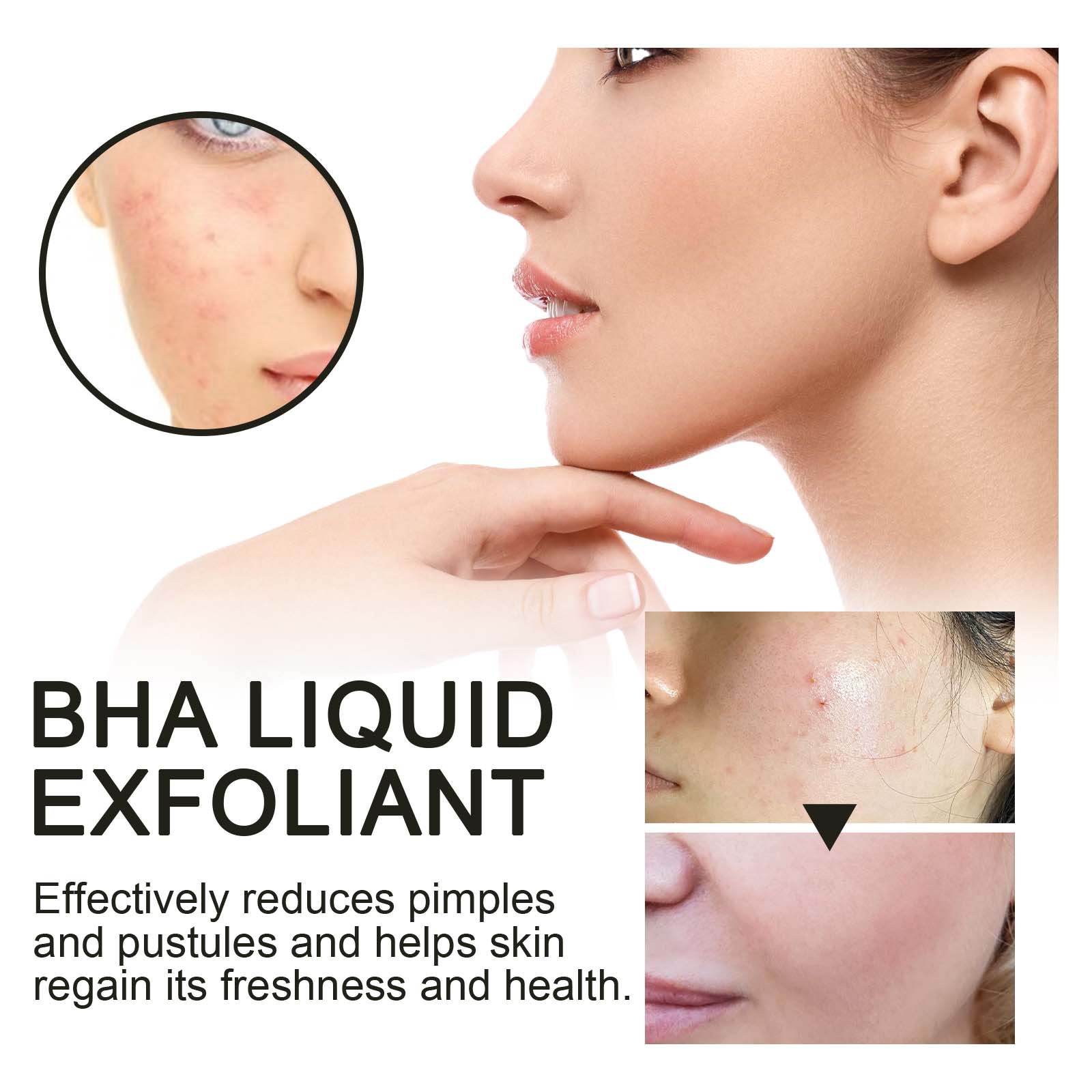2% Salicylic Acid Liquid Exfol - Tranexamic Acid Serum ulasan dan harga
